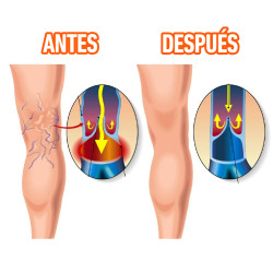 MEDIAS PRE VARICES CON ZIPPER 8-15