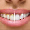 SISTEMA DE LIMPIEZA DENTAL MIRACLE SMILE